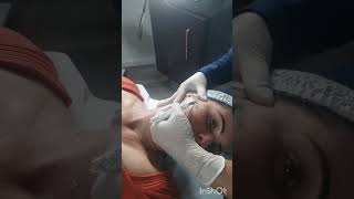 Dermaplaning na prática dermaplaningfacial dermaplaning peeling estetica peelingfacial [upl. by Ardnasxela]