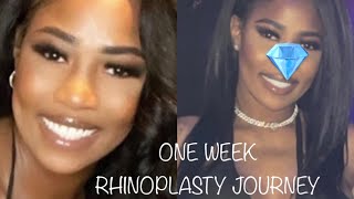 Rhinoplasty Vlog [upl. by Eboh]