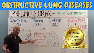 Obstructive Lung Diseases  COPD Chronic Bronchitis Asthma Bronchiectasis amp Emphysema🩺 [upl. by Alrrats486]