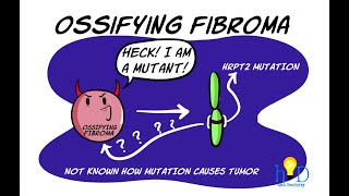 Cementoossifying fibroma  Controversies Clinical features Radiology and Histopathology [upl. by Ecnerat448]