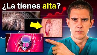 ¡Qué Ocurre en tu Cuerpo si tienes TESTOSTERONA ALTA [upl. by Jahn]