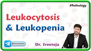 18 Leukocytosis and Leukopenia  USMLE Step 1 Pathology [upl. by Oeak]