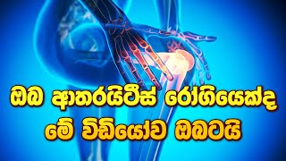 ඔබ ආතරයිටීස් රෝගියෙක්ද මේ විඩියෝව ඔබටයි ayurveda arthritistreatment arthritis [upl. by Noryt836]