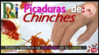 🕷️🐛 Picaduras de chinches  Piquetes de chinches  Como eliminar chinches de la cama picaduras 🛏️ [upl. by Eelyah]