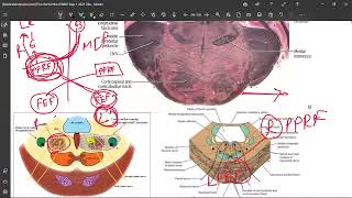 33 Locked in Syndrome Medial Pontine Syndrome [upl. by Faxan]