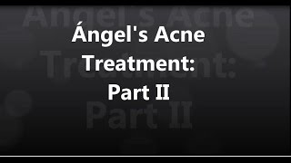 Ángels Acne Treatment 2 [upl. by Alber]