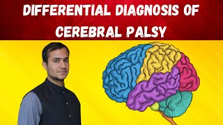 Cerebral palsy approach and differential diagnosis [upl. by Adyaj]