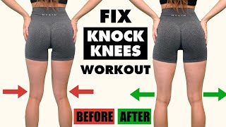 10 Min quotKnock Kneesquot Home Workout  FIX Knock Knees in 10 MinDay [upl. by Seavir258]