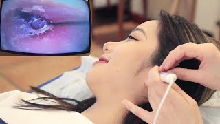 【ASMR】Experience the most professional visual ear cleaning Dig earwax relax ear massage [upl. by Arrad944]