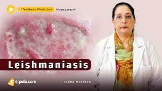 Leishmaniasis  Infectious Clinical Medicine Video  VLearning  sqadiacom [upl. by Ynnad]