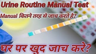 Urine routine  Urine test kit  How many type of urine test [upl. by Asilenna54]