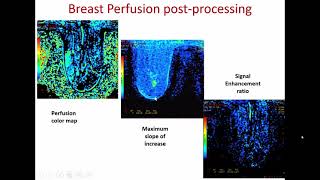 MRI PLANNNING TECHNIQUES ampTRICKS FOR IMAGING [upl. by Liesa]