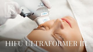 HIFU Ultraformer III  Behandlungsablauf  FineSkin [upl. by Yaeger]