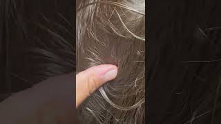 See any lice l lice removal service explore hair headlice hairtok lice [upl. by Tabitha]