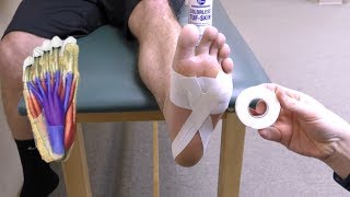 Teardrop Arch Taping for Plantar Fasciitis [upl. by Ellett]