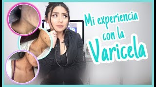 Mi experiencia con la varicela STORYTIME iambreen [upl. by Adnor125]