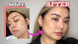 💄💜✨AFFORDABLE Makeup For ECZEMA Prone Skin Atopic Dermatitis tutorial [upl. by Isus]