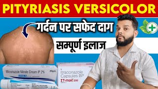 गर्दन पर सफेद दाग धब्बे का इलाज  Pityriasis Versicolor Causes Symptoms And Treatment [upl. by Arvonio]