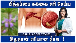 பித்தப்பை கல் பிரச்சனையா   Gallbladder Stones Removal Without Surgery   Dr BYoga Vidhya [upl. by Newcomb273]