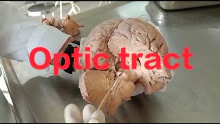 Neuroanatomy Optic pathway anatomy of optic pathway [upl. by Koorb980]