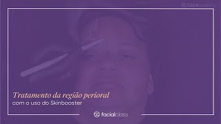 Tratamento da região perioral com o uso do Skinbooster  Facial Class [upl. by Albie]