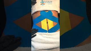 Técnica Kinesiotaping 💆🏻‍♀️✨ estetica kinesiotape esteticista fisioterapia [upl. by Arymas]