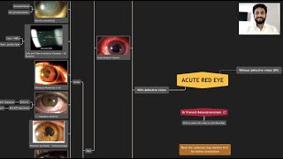 Acute Red Eye  Master the Differential Diagnoses with Mind Map [upl. by Enyar695]