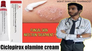 Ciclopirox olamine cream usp  Uses sideeffects directions  Fungal infection treatment in Hindi [upl. by Eugenie537]