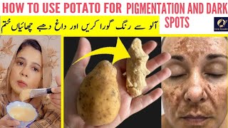 POTATO and BESAN Miracle Cure for Pigmentation amp Melasma  How to Remove Dark Spots Naturally [upl. by Benedikt]