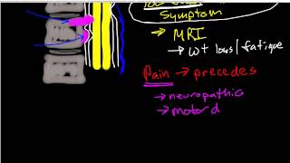 Oncologic Emergencies Spinal Cord Compression [upl. by Anitnoc308]