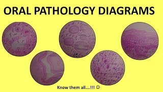 Oral Pathology Diagrams  BDS Third Year  Histopathology [upl. by Anelas]