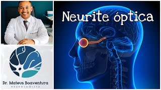 Tudo sobre neurite óptica [upl. by Sum]