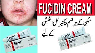 fusidic acid cream how to use Fusidic acid cream fucidin cream in urdu [upl. by Denice]