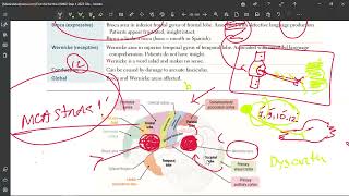 42 Aphasia amp Dysarthria [upl. by Nahshun900]