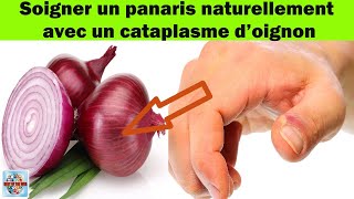 Astuces de grandmère  comment soigner un panaris avec un cataplasme à base doignon [upl. by Navy]