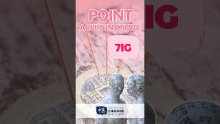 POINT D’ACUPUNCTURE  7IG  Zhi Zheng acupuncture acupuncturepoints medecinechinoise [upl. by Mosira99]