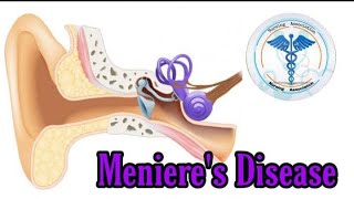 Menieres Disease  Nursing Lecture [upl. by Solberg36]