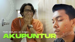 MENCOBA AKUPUNTUR UNTUK PERTAMA KALINYA  TAPI BOLEH DICOBA [upl. by Richart]