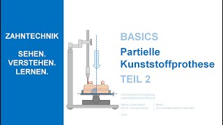 Partielle Kunststoffprothese  Teil 2 [upl. by Asined]