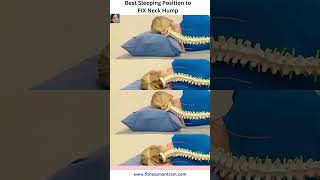 Best Sleeping Posture to fix Neck Hump Dowagers Hump neckpain fitnessmantram [upl. by Ardisj757]