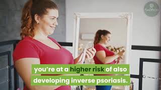 Inverse Psoriasis Causes and Treatments [upl. by Rog664]