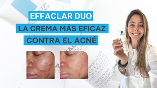 EFFACLAR DUO de La Roche Posay ¿la MEJOR crema para el ACNÉ  Mi opinión después de 8 años [upl. by Rudin]