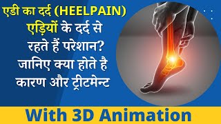 एड़ी में दर्द लक्षण कारण उपचार प्रक्रिया कीमत और दुष्प्रभाव  Heel pain क्यों होता है [upl. by Vanhook]