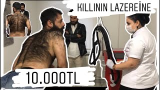 DÜNYANIN EN KILLI ADAMINA LAZER YAPTIRMAK [upl. by Rillings]