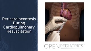 Pericardiocentesis During Cardiopulmonary Resuscitation by T Wolbrink  OPENPediatrics [upl. by Hanleigh]