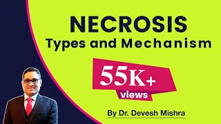 Necrosis  Types and Mechanism General Pathology [upl. by Allekram]