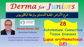 028 Lupus Erythematosus LE Autoimmune Connective tissue diseases [upl. by Punak]