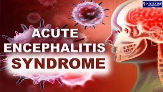 DNS ACUTE ENCEPHALITIS SYNDROME [upl. by Chapland]