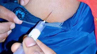 Arms injection Im suma ject injection video জন্মবিরতিকরণ ইনজেকশন 24 Ep93 by LaFiN injection push [upl. by Egiaf184]