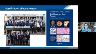 SPAEN Annual Conference 2021 Bone Sarcomas quotImproving the understanding of bone sarcomasquot [upl. by Nnelg757]